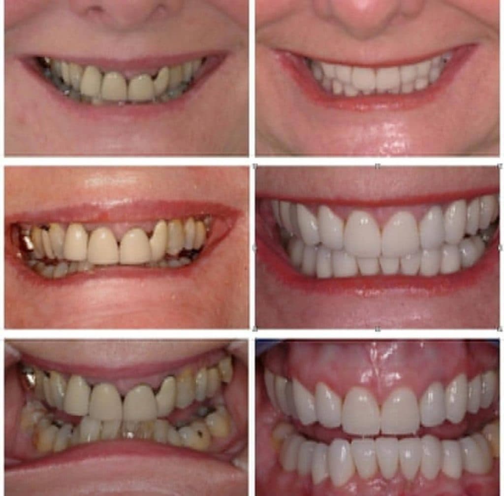 مطب دندانپزشکی و ایمپلنت دکتر رضا شکیبایی در سلسبیل تهران