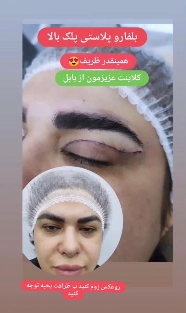 کلینیک پوست و مو تینا در ساری