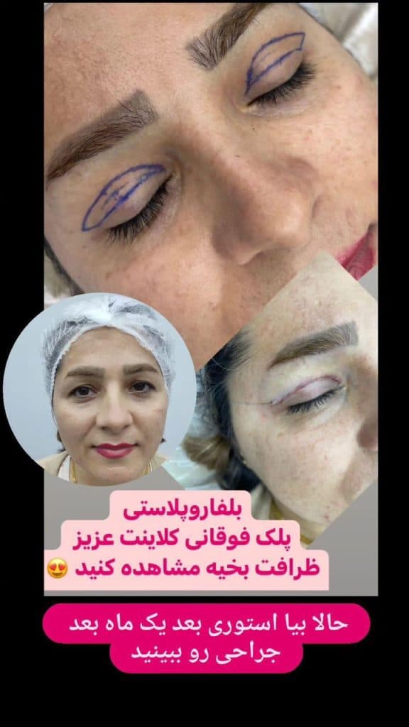 کلینیک پوست و مو تینا در ساری