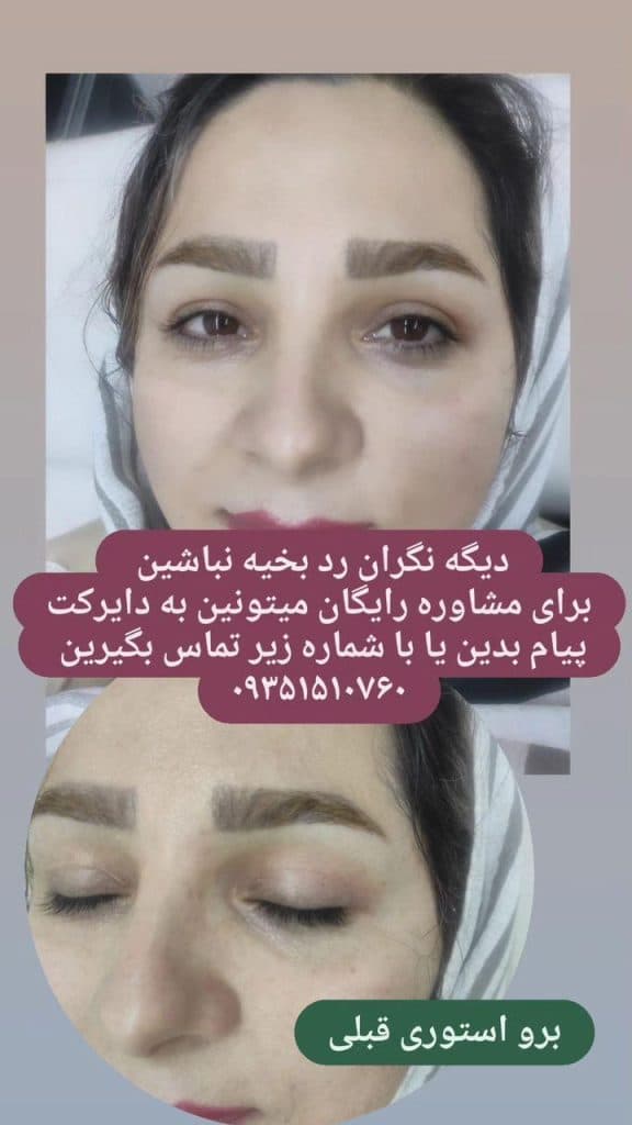 کلینیک پوست و مو تینا در ساری