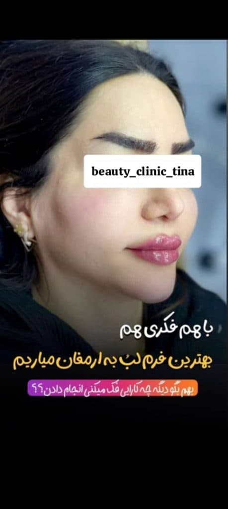 کلینیک پوست و مو تینا در ساری