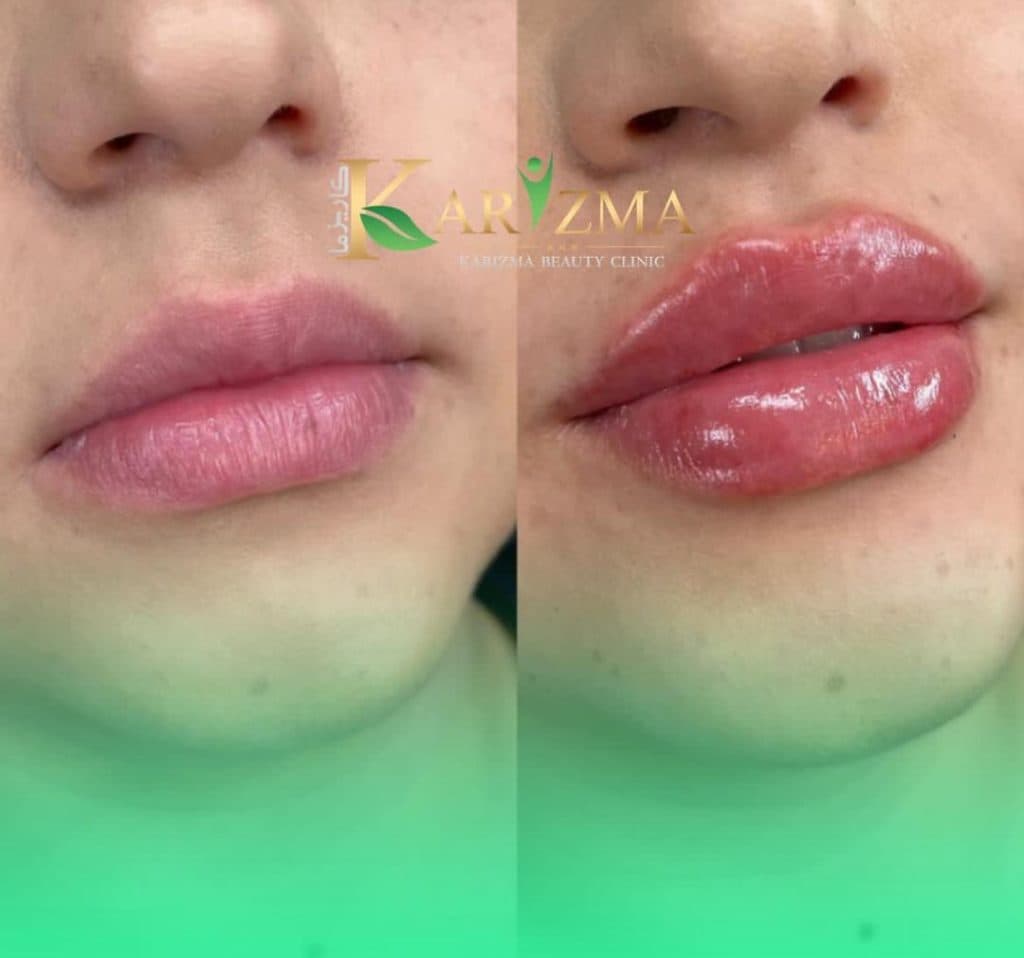 کلینیک زیبایی کاریزما در دروازه شیراز اصفهان