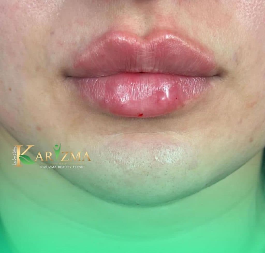 کلینیک زیبایی کاریزما در دروازه شیراز اصفهان