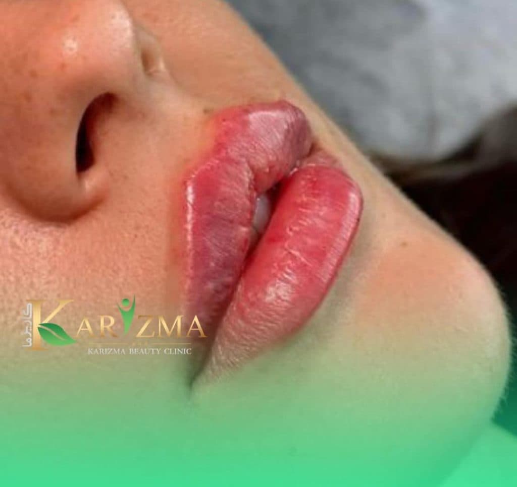 کلینیک زیبایی کاریزما در دروازه شیراز اصفهان