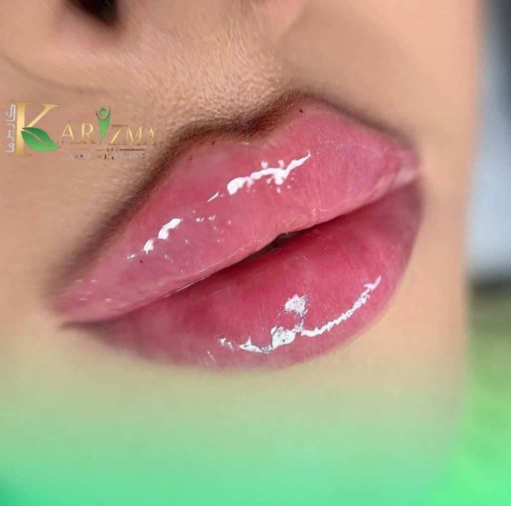 کلینیک زیبایی کاریزما در دروازه شیراز اصفهان