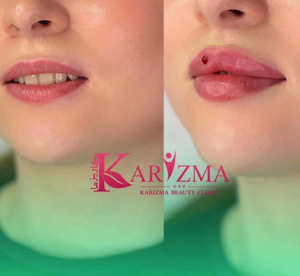 کلینیک زیبایی کاریزما در دروازه شیراز اصفهان