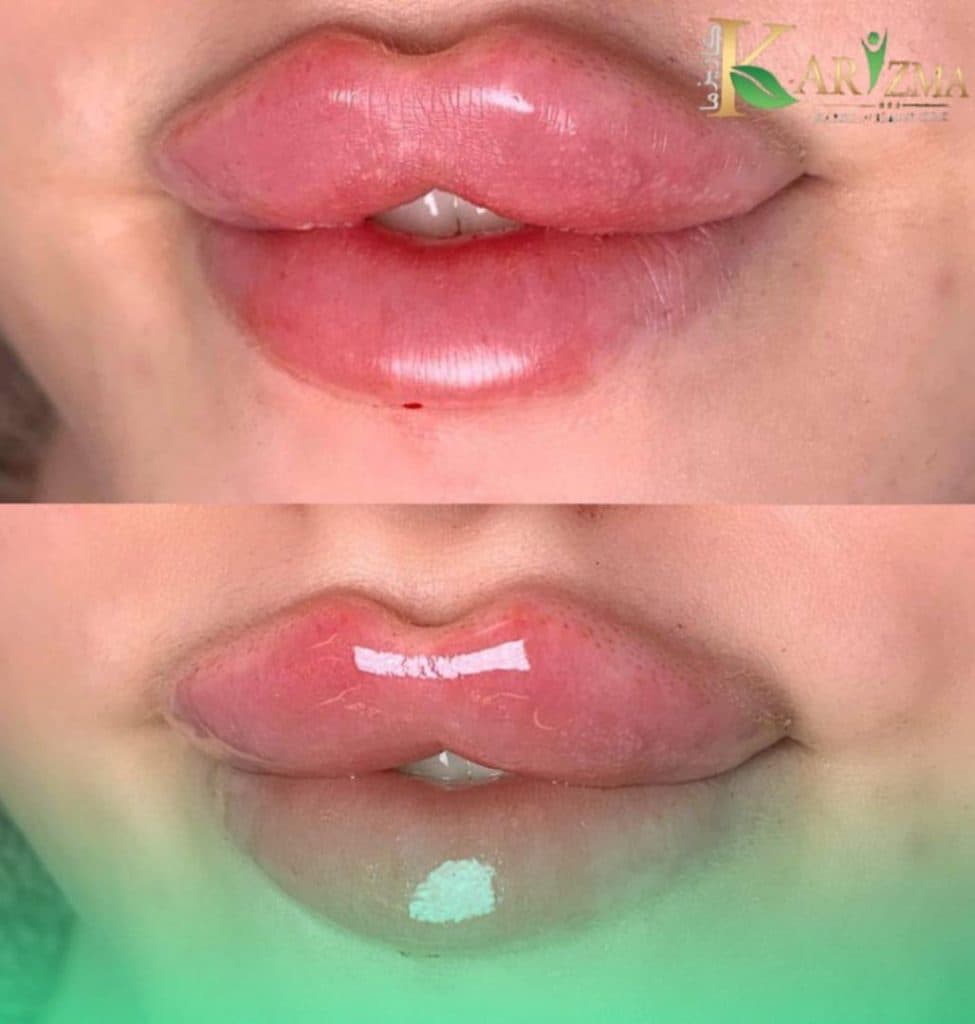 کلینیک زیبایی کاریزما در دروازه شیراز اصفهان