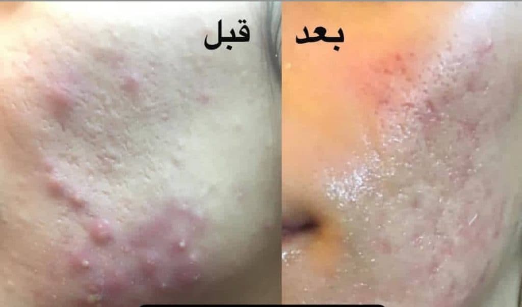 کلینیک زیبایی تزریق فیلر لب روسی بنیتا در تهرانپارس