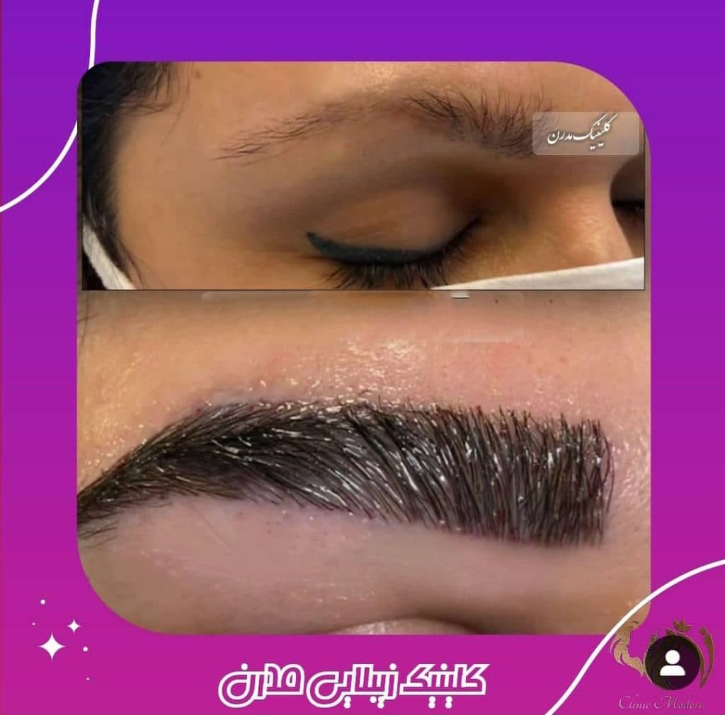 کلینیک زیبایی مدرن رئیسی در قزوین