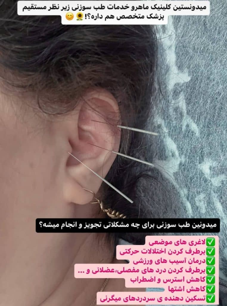 کلینیک زیبایی و درمانی ماهرو در گرگان