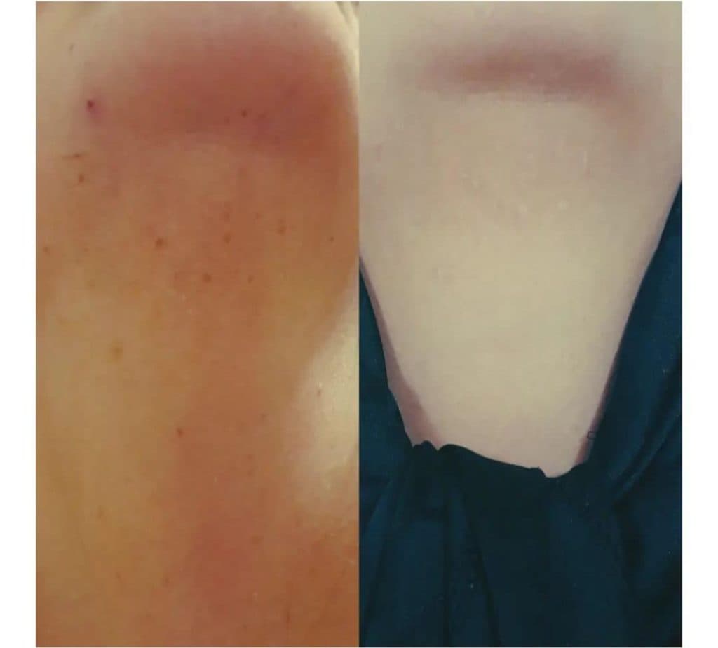 مرکز تخصصی خالبرداری رویا رضایی در ارومیه