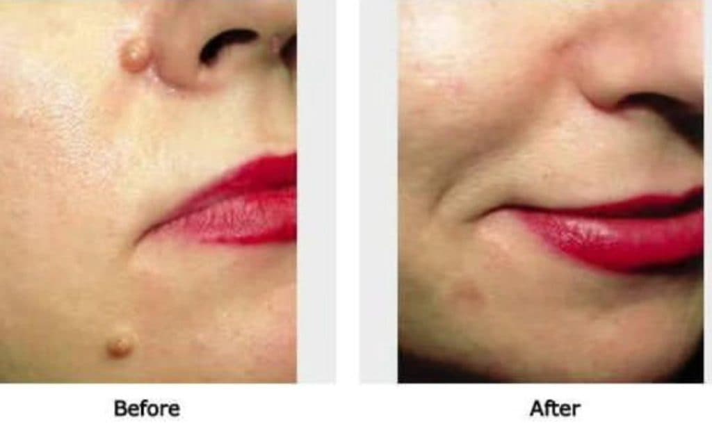 مرکز تخصصی خالبرداری رویا رضایی در ارومیه