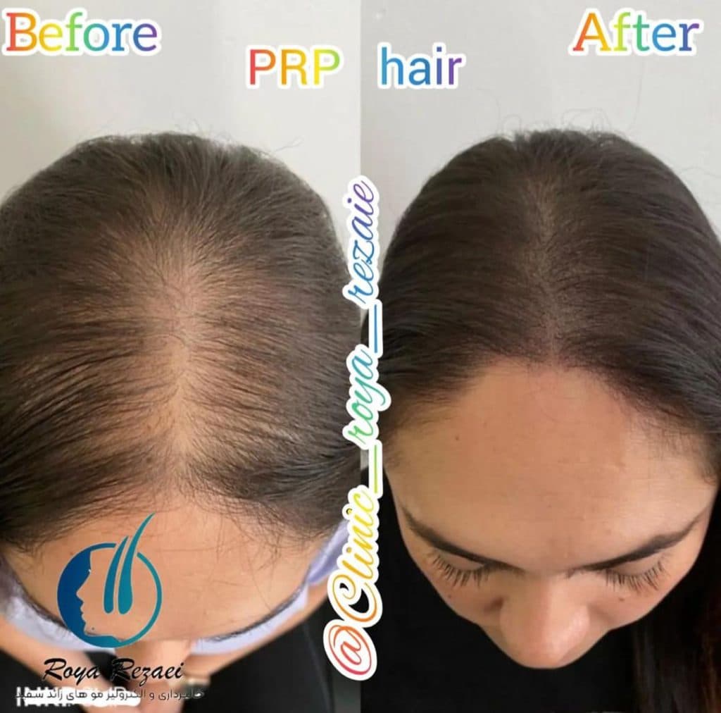 مرکز تخصصی خالبرداری رویا رضایی در ارومیه