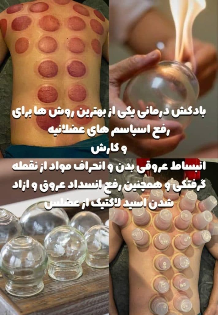 ماساژ درمانی دیلم در بابلسر