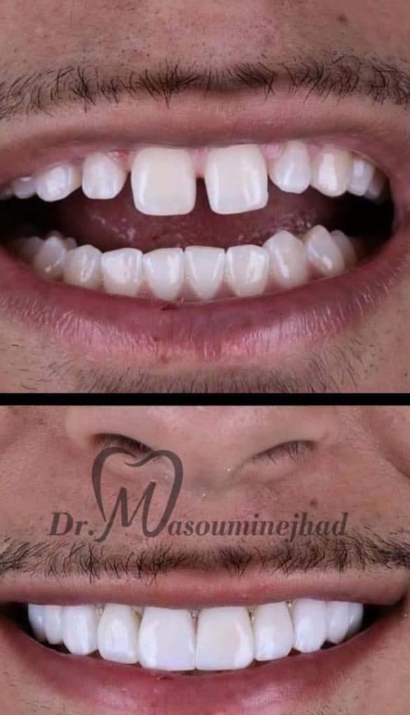 مطب دندانپزشکی دکتر مصیب معصومی نژاد در 17 شهریور تبریز