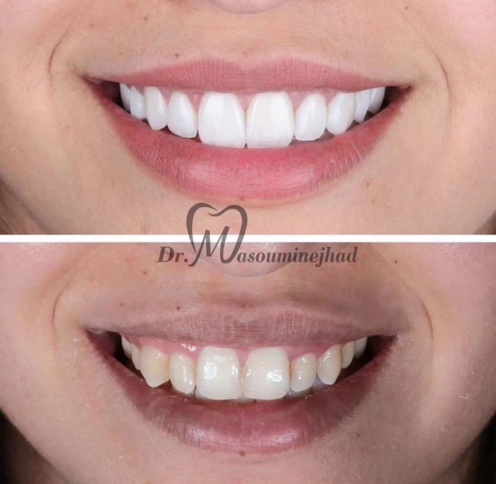 مطب دندانپزشکی دکتر مصیب معصومی نژاد در 17 شهریور تبریز