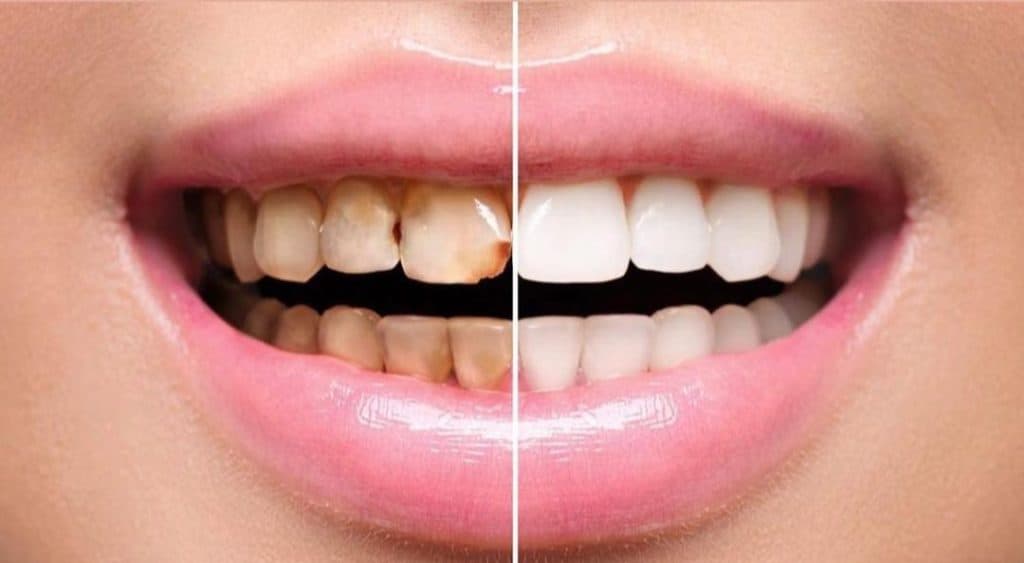 مطب دندانپزشکی دکتر مصیب معصومی نژاد در 17 شهریور تبریز