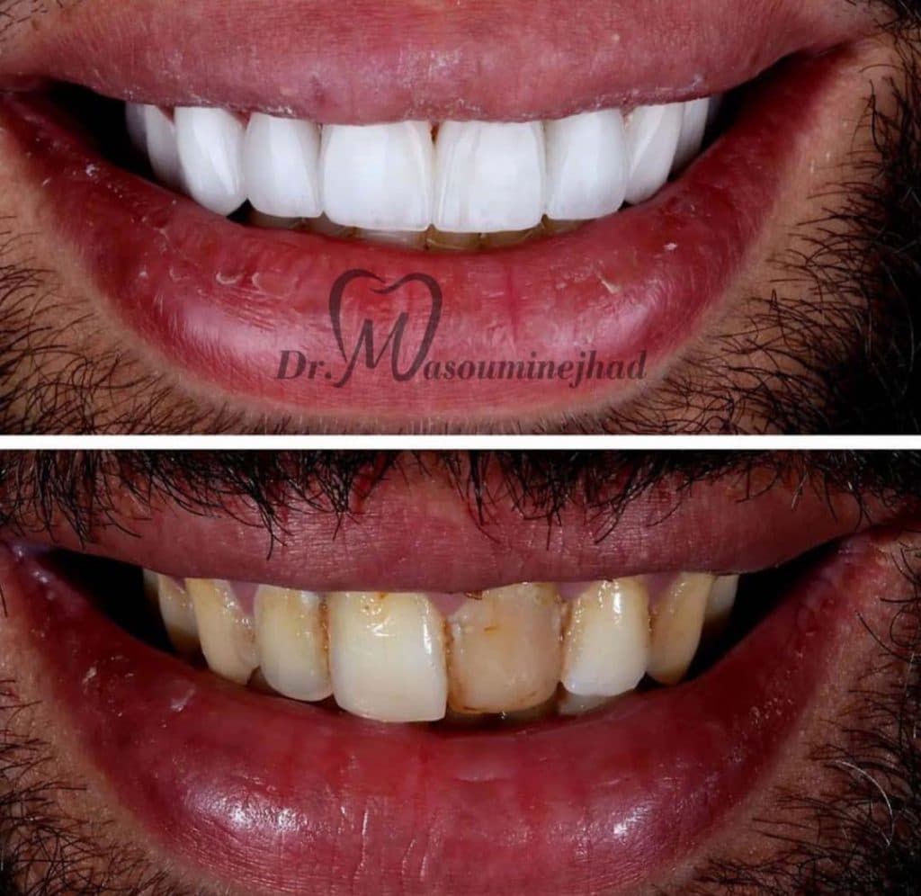 مطب دندانپزشکی دکتر مصیب معصومی نژاد در 17 شهریور تبریز