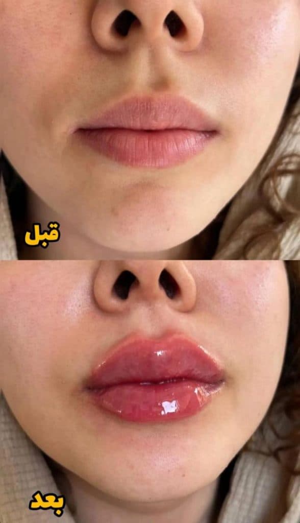 مرکز لیزر تارا در آخر جلالیه تبریز