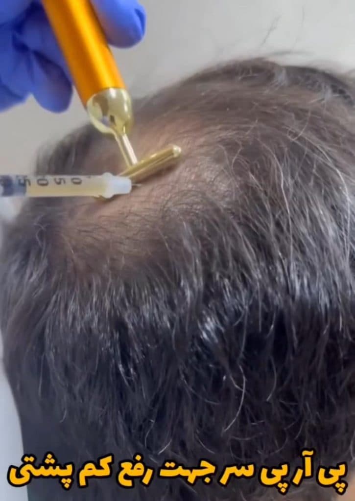 مرکز لیزر تارا در آخر جلالیه تبریز