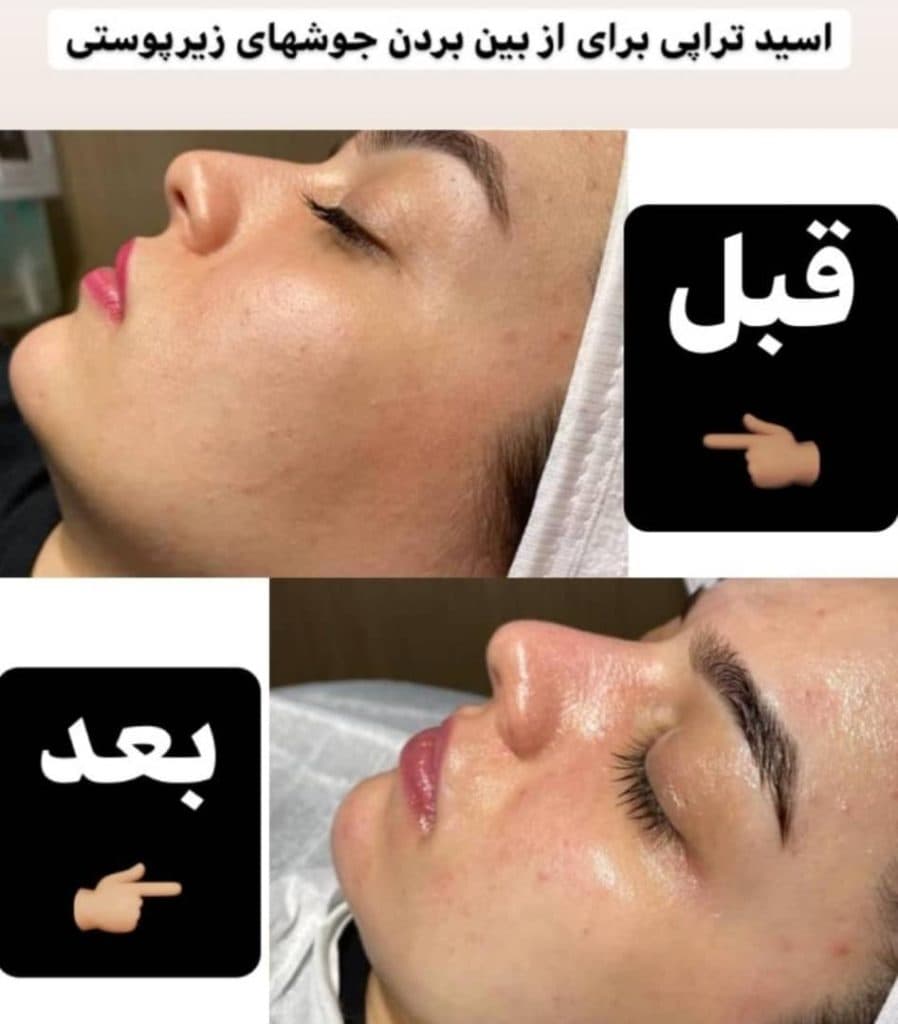 آموزشگاه مراقبت زیبایی ندا اکرمی در کلاردشت
