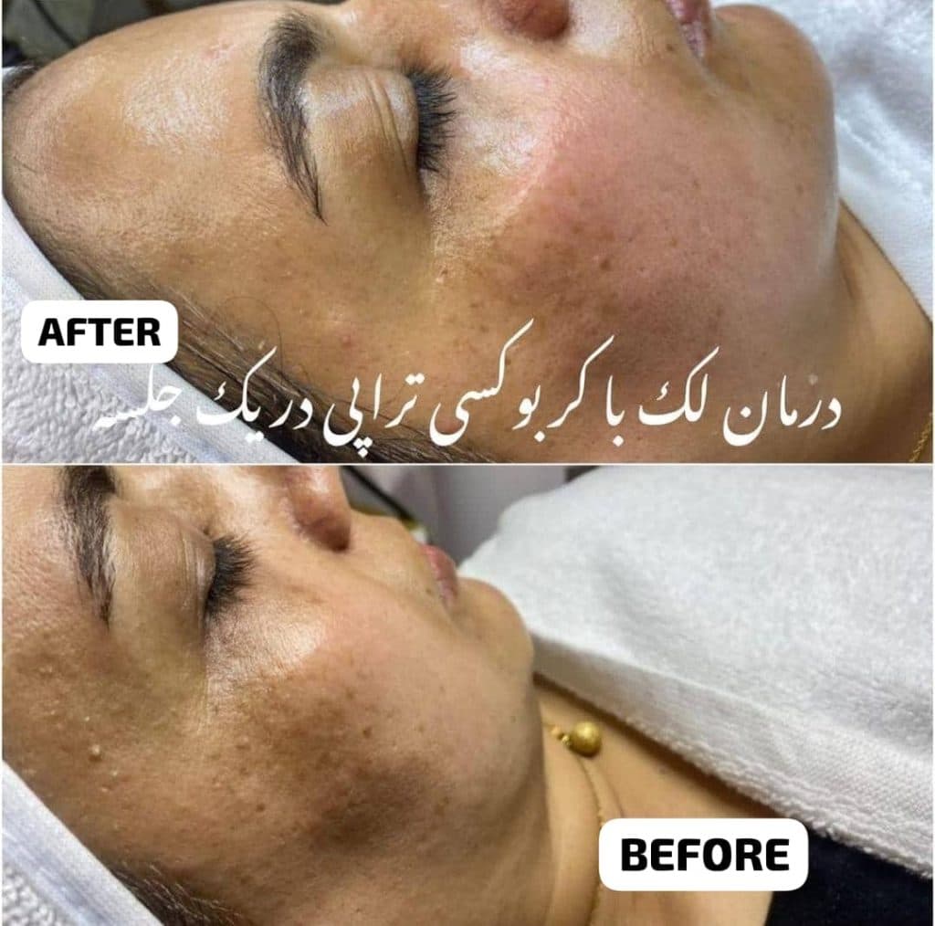 آموزشگاه مراقبت زیبایی ندا اکرمی در کلاردشت