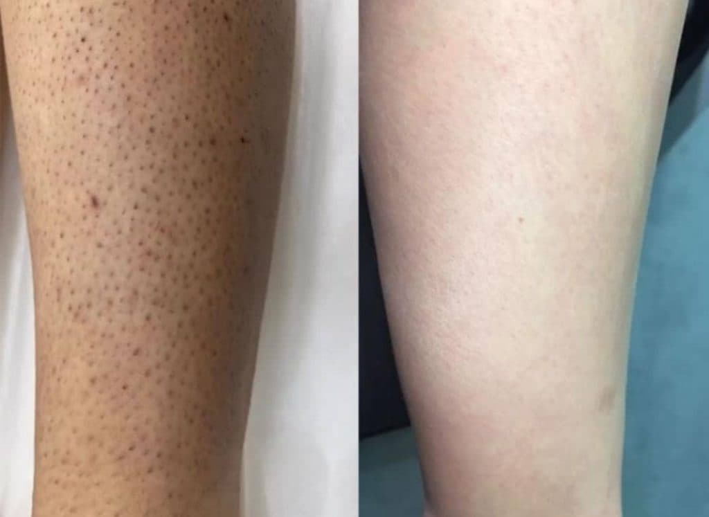 مرکز زیبایی نیلارز در رفسنجان