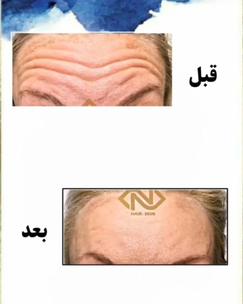 کلینیک پوست و مو نیلوفر در مشهد