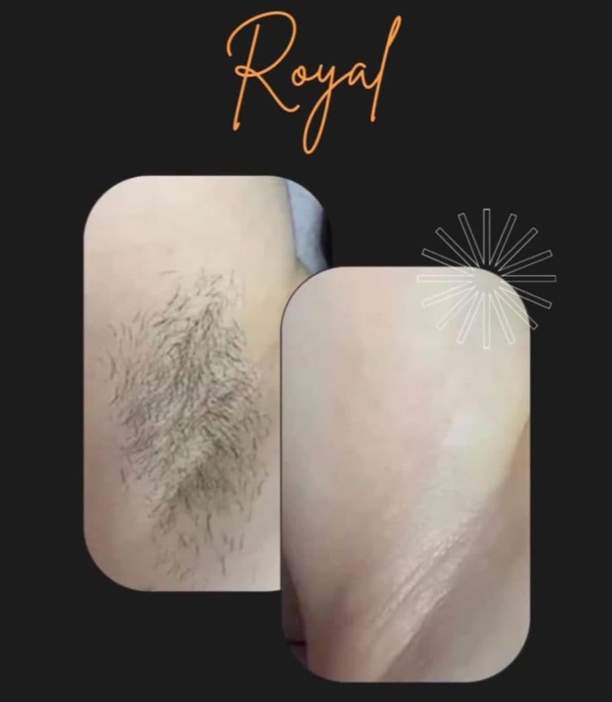 کلینیک تخصصی لیزر رویال در تختی میاندوآب