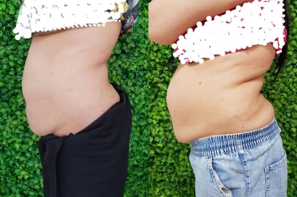 کلینیک تخصصی لاغری و تناسب اندام امولای در بلوار احمدآباد مشهد