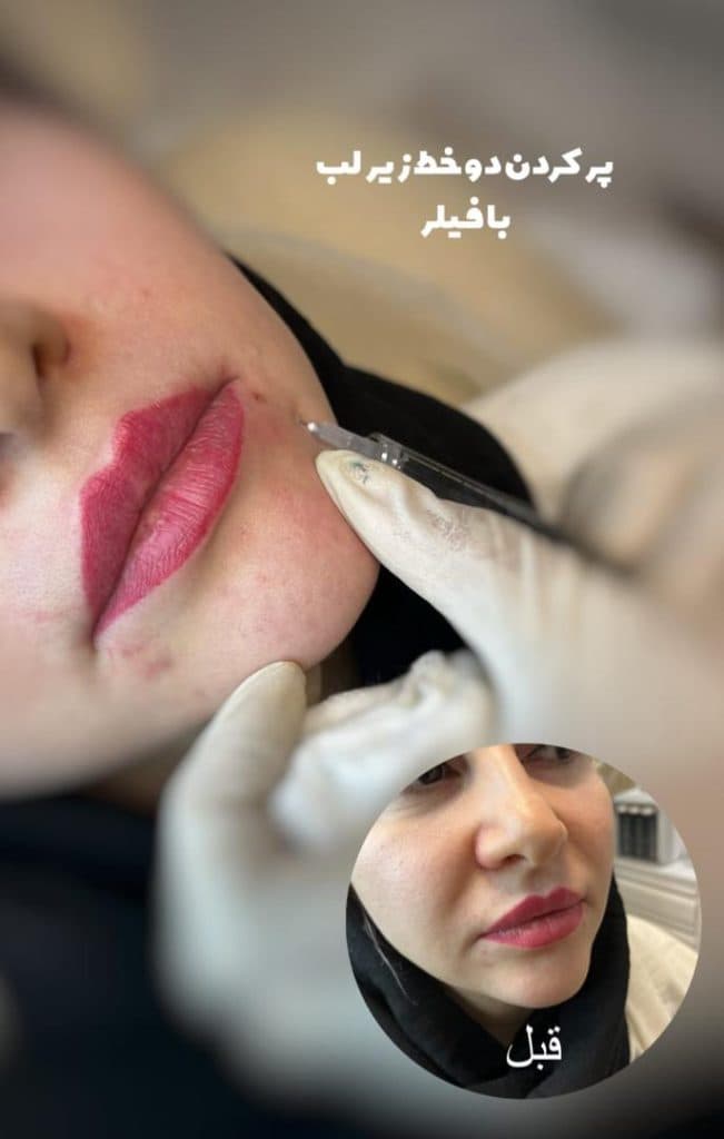 مطب زیبایی مهرنوش احمدی در 24 متری شهریار زنجان