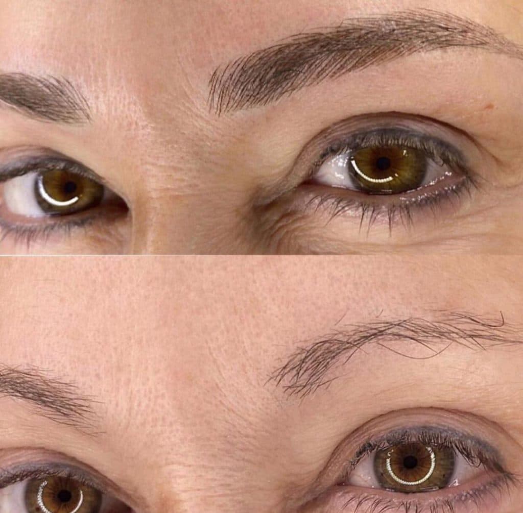 خدمات تخصصی میکروبلیدینگ شاپرک در بلوار سیمون بولیوار تهران