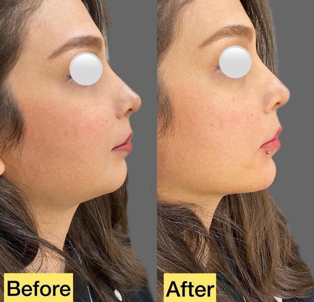 مطب زیبایی دکتر صدف صائب در قدوسی شرقی شیراز