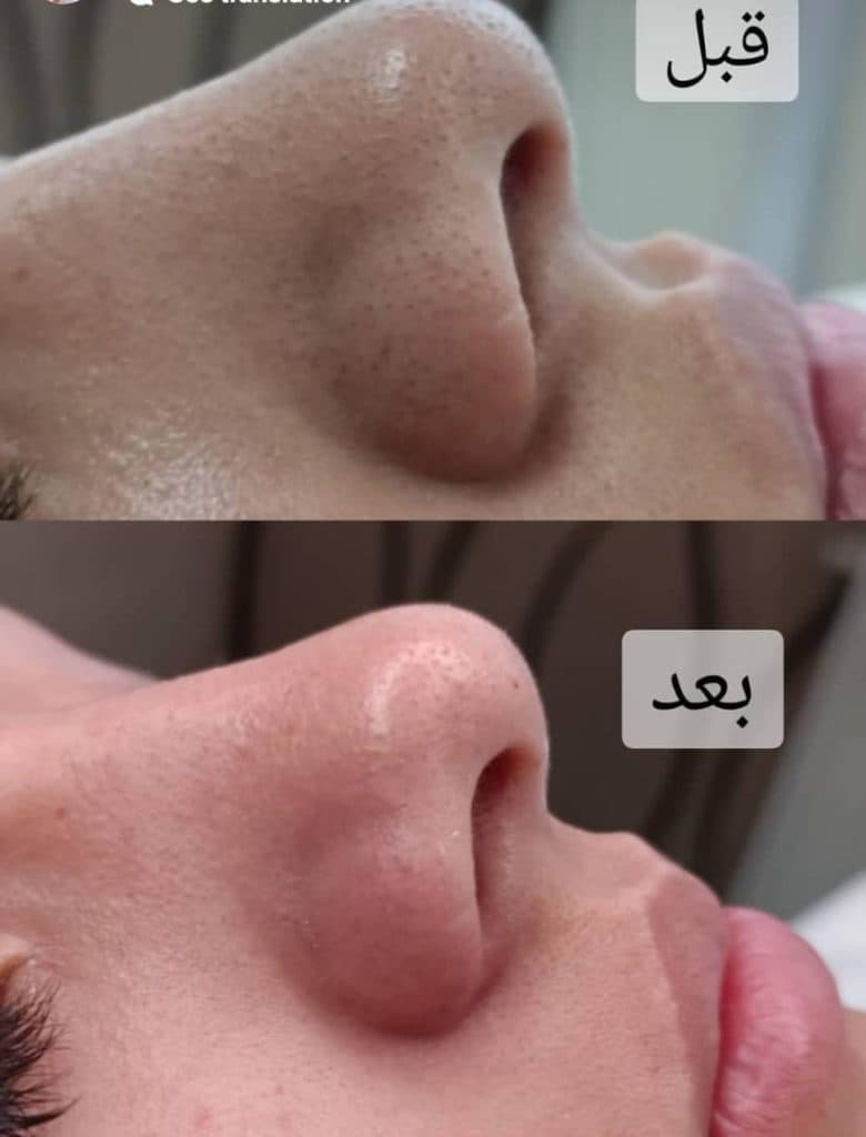 فیشال کیمیا در شاهین شهر