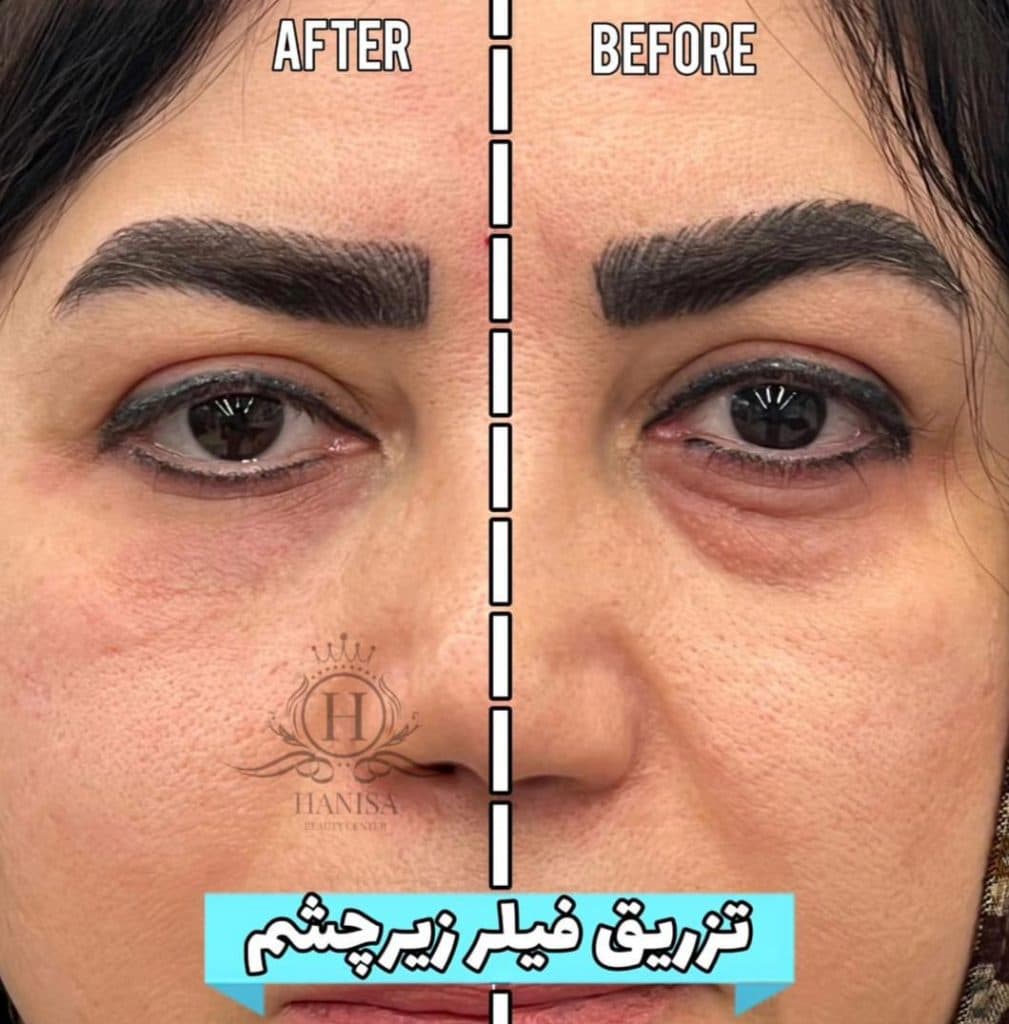 کلینیک زیبایی هانیسا در تهرانپارس تهران