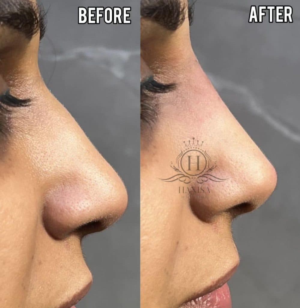 کلینیک زیبایی هانیسا در تهرانپارس تهران