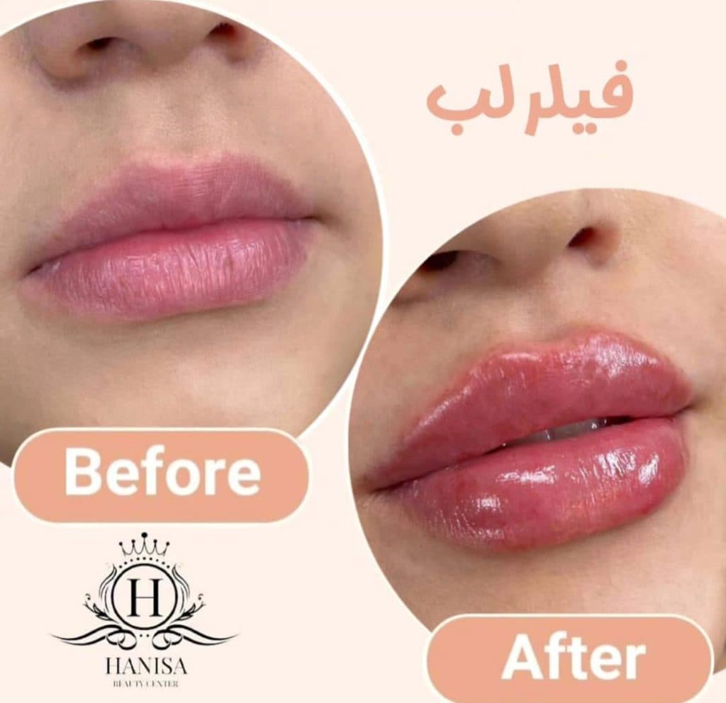 کلینیک زیبایی هانیسا در تهرانپارس تهران