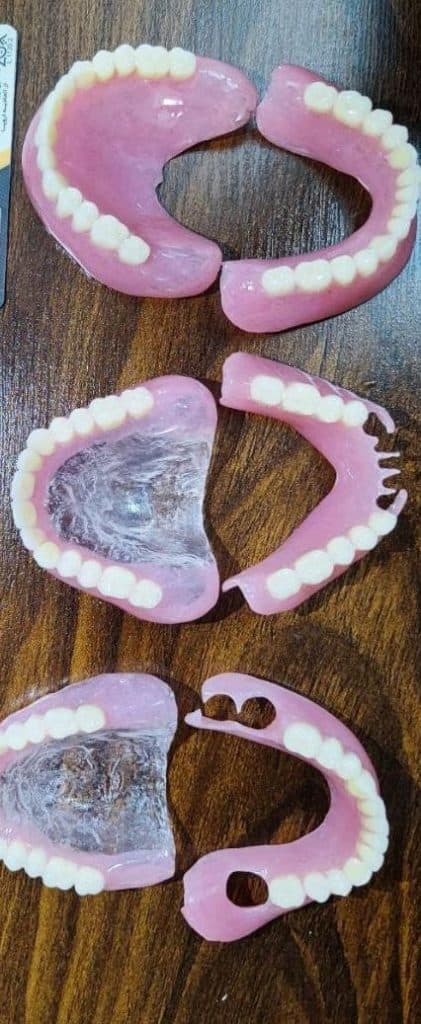 لابراتور دندانسازی اهورا در مشهد