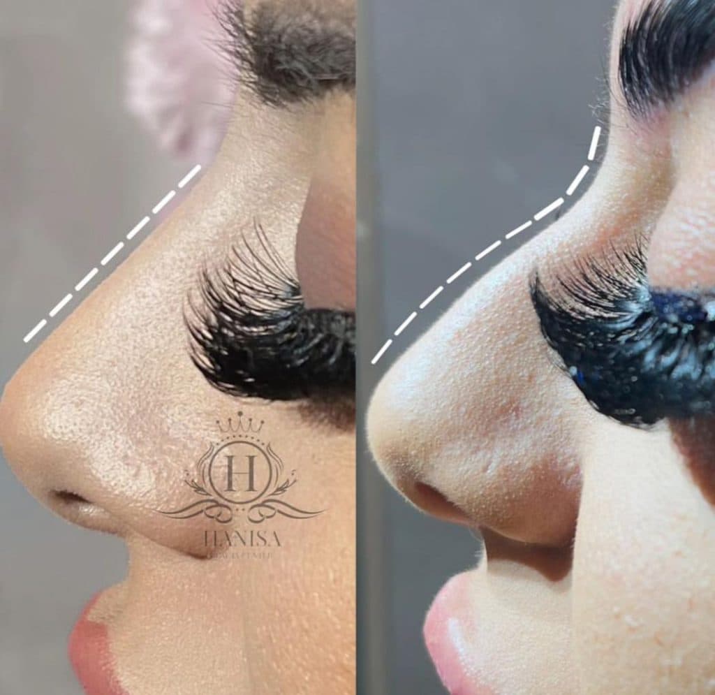 کلینیک زیبایی هانیسا در تهرانپارس تهران