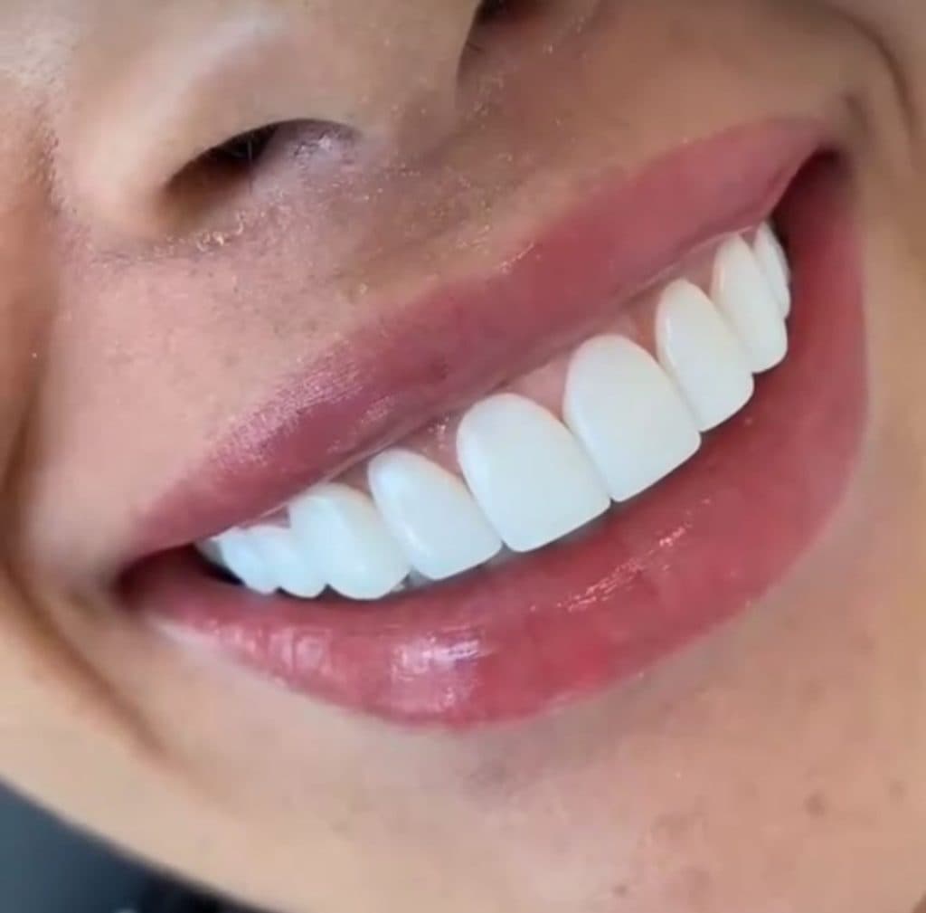 کلینیک دندانپزشکی لبخند در گوهردشت کرج