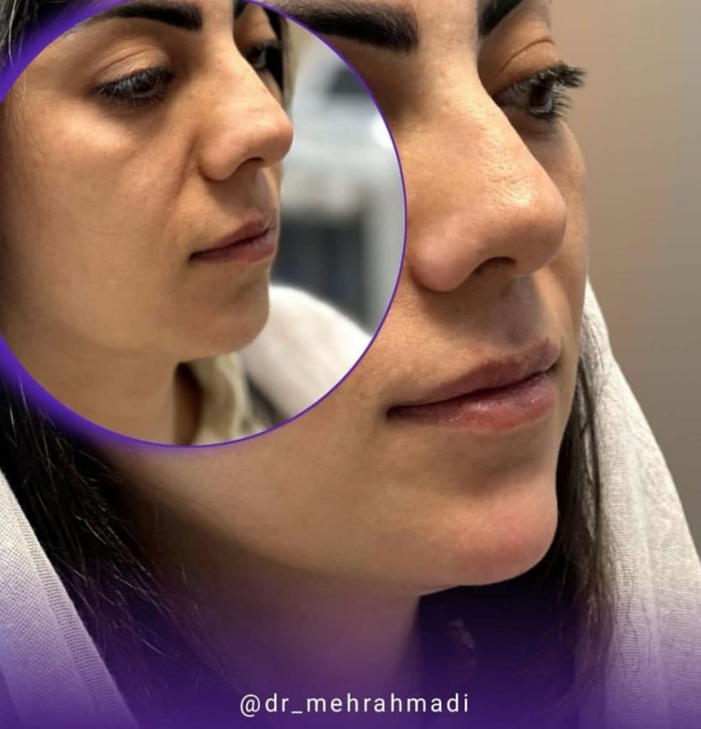 مطب زیبایی مهرنوش احمدی در 24 متری شهریار زنجان