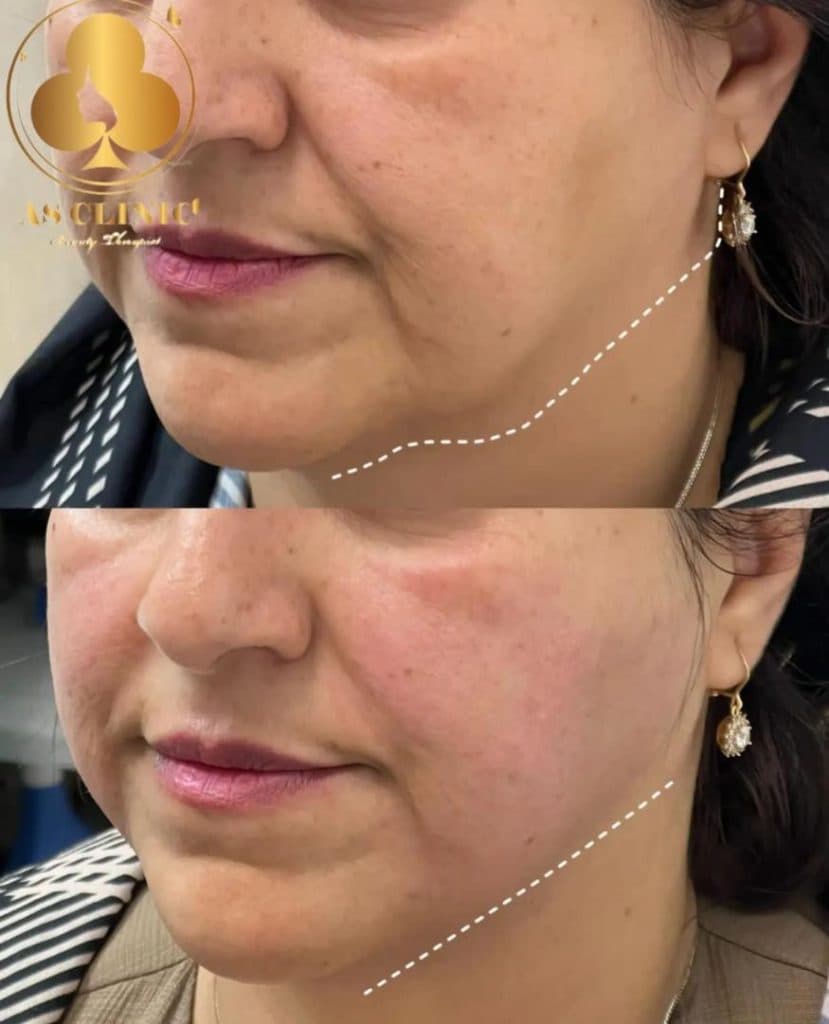 کلینیک زیبایی آس در چهارراه عمار یاسر ارومیه