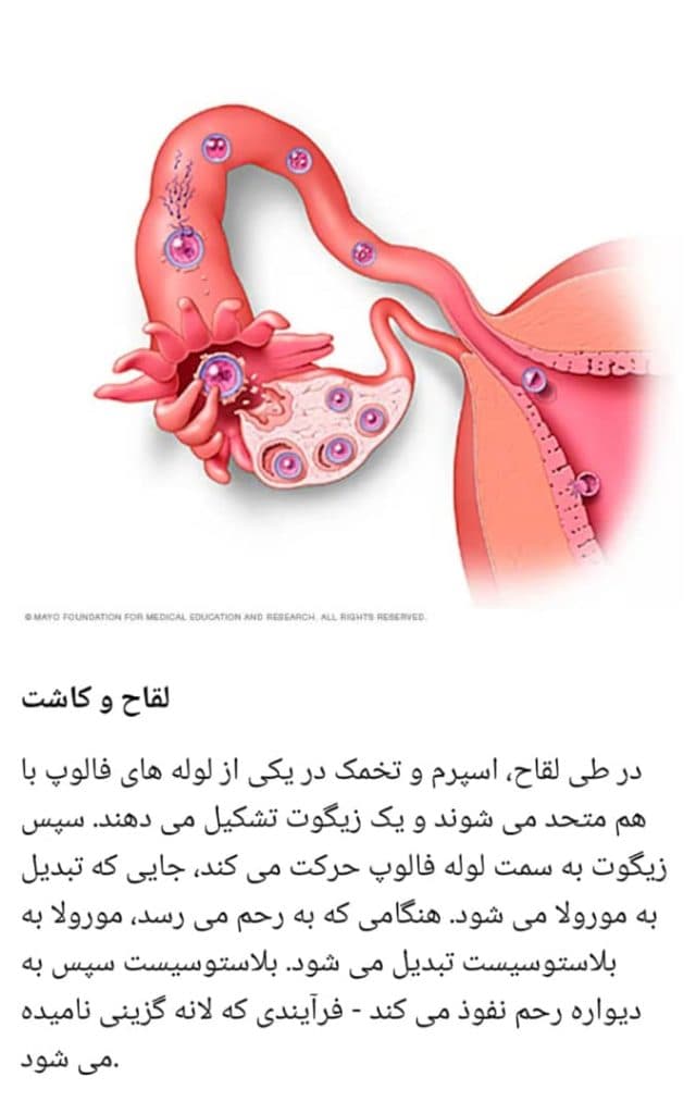 فروش مکمل های ناباروری تقویت اسپرم مردان آنلاین طب باروا در اصفهان