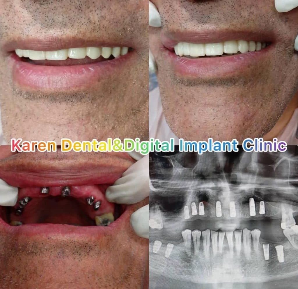 کلینیک دندانپزشکی و ایمپلنت دیجیتال کارن در کرمان