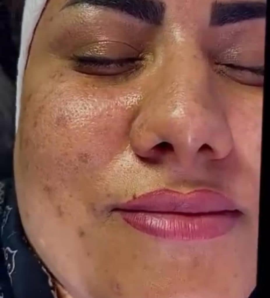 مرکز تخصصی ترمیم پوست و مو ماهک در صفائیه یزد