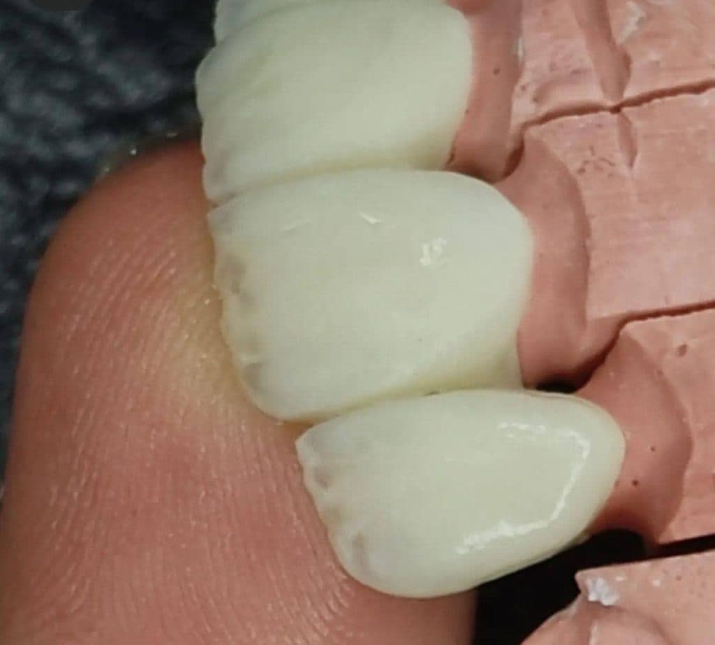 مرکز تخصصی دیجیتال پروتز دندان خدایاری در پاستور جدید تبریز