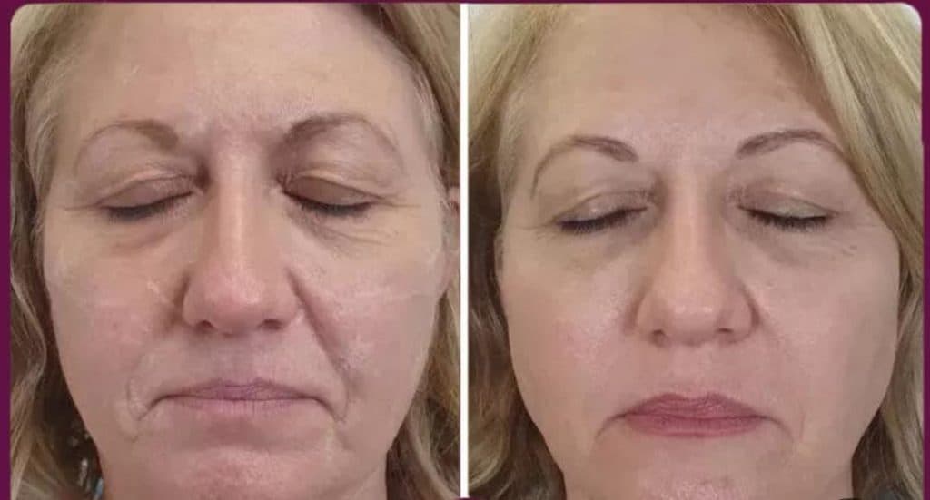 خدمات تخصصی پوست و مو منیره بیوتی در پونک جنوبی تهران