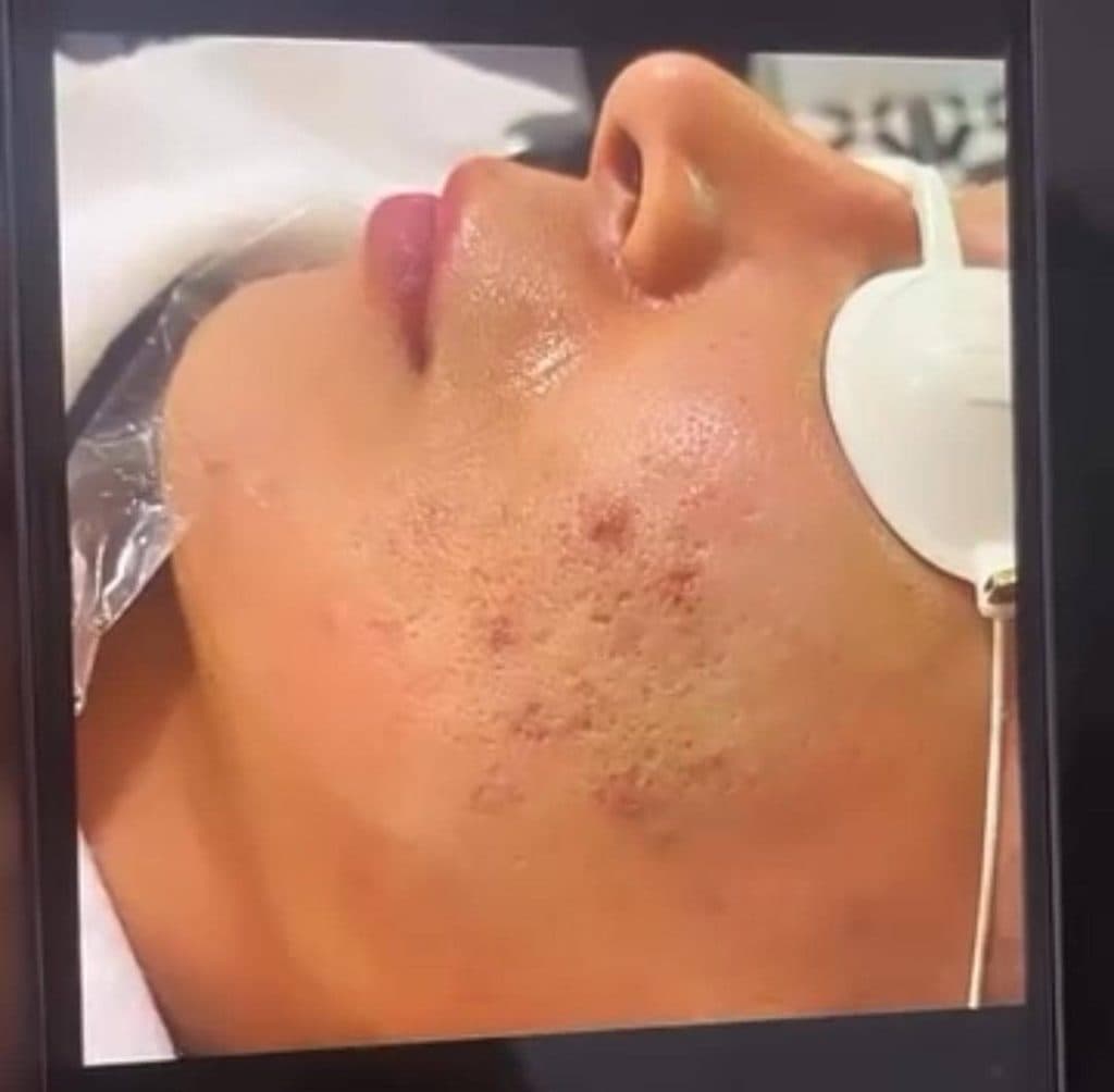 مرکز تخصصی ترمیم پوست و مو ماهک در صفائیه یزد