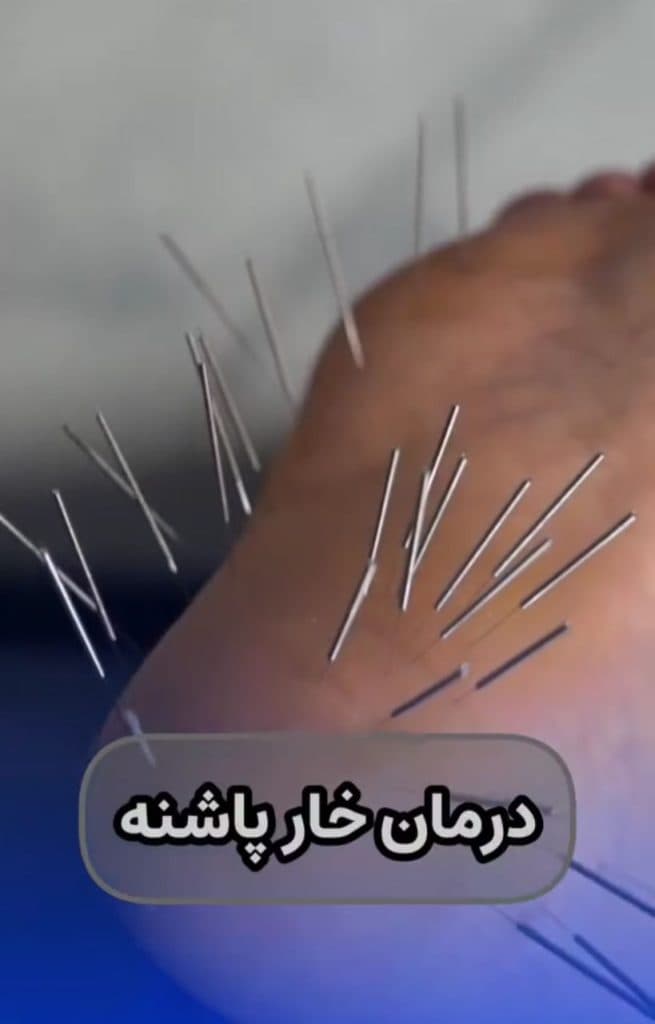 کلینیک ارتوپدی توان کار در سلیمانیه تهران