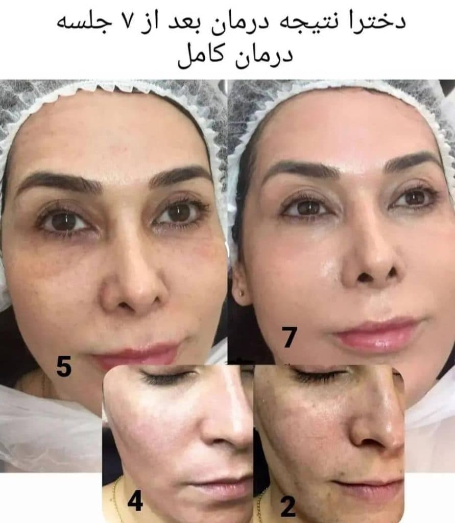 مرکز تخصصی ترمیم پوست و مو ماهک در صفائیه یزد